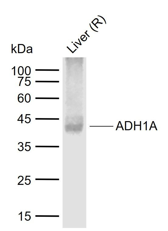 ADH1A Antibody in Western Blot (WB)