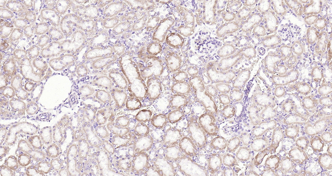 MARK2 Antibody in Immunohistochemistry (Paraffin) (IHC (P))