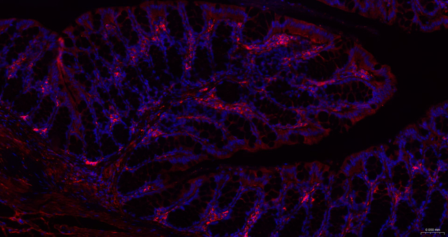 LUM Antibody in Immunohistochemistry (Paraffin) (IHC (P))