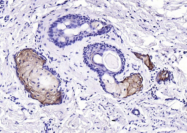 FASN Antibody in Immunohistochemistry (Paraffin) (IHC (P))