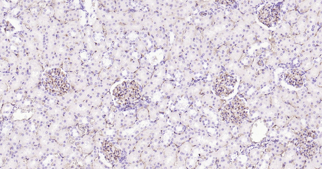 CD34 Antibody in Immunohistochemistry (Paraffin) (IHC (P))