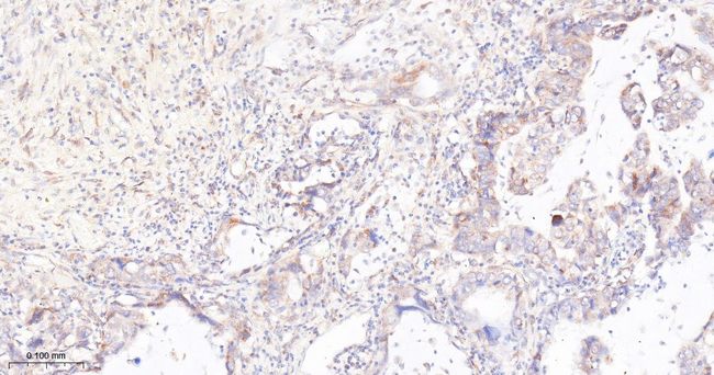 mTOR Antibody in Immunohistochemistry (Paraffin) (IHC (P))