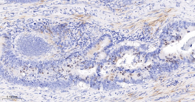 Survivin Antibody in Immunohistochemistry (Paraffin) (IHC (P))