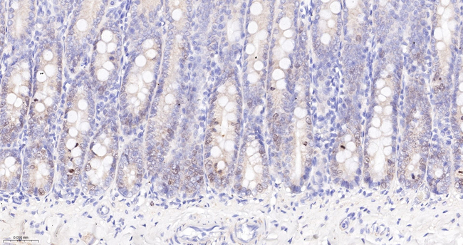 Survivin Antibody in Immunohistochemistry (Paraffin) (IHC (P))