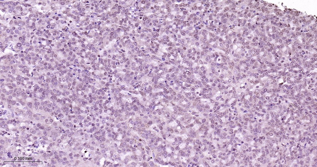 Phospho-STAT5 alpha (Tyr694) Antibody in Immunohistochemistry (Paraffin) (IHC (P))