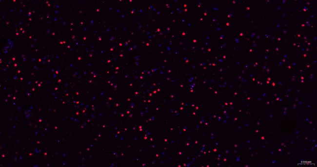 SOX1 Antibody in Immunohistochemistry (Paraffin) (IHC (P))