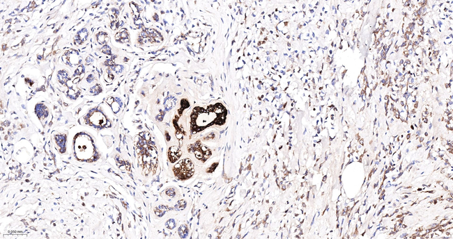 GCDFP-15 Antibody in Immunohistochemistry (Paraffin) (IHC (P))