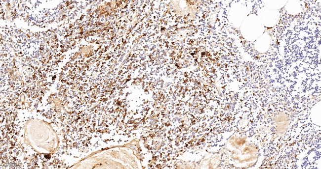CD16 Antibody in Immunohistochemistry (Paraffin) (IHC (P))