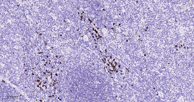 Kappa Light Chain Antibody in Immunohistochemistry (Paraffin) (IHC (P))