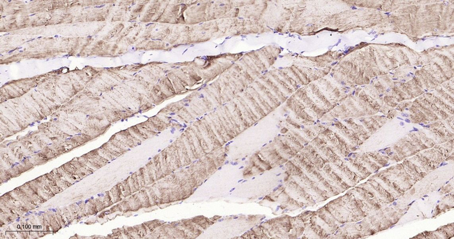ADFP Antibody in Immunohistochemistry (Paraffin) (IHC (P))