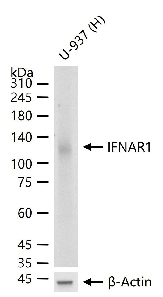 IFNAR1 Antibody in Western Blot (WB)