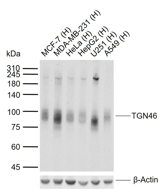 TGN46 Antibody in Western Blot (WB)