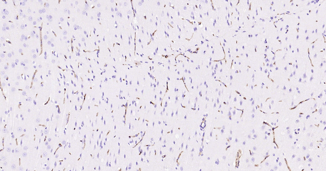 ABCB1 Antibody in Immunohistochemistry (Paraffin) (IHC (P))