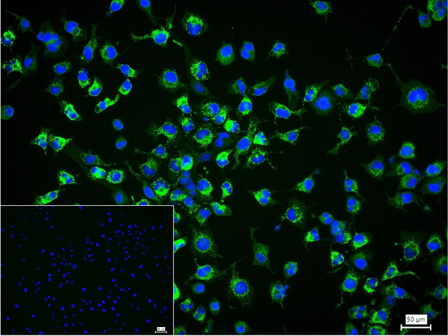 Collagen III Antibody in Immunocytochemistry (ICC/IF)