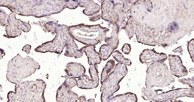 Phospho-eNOS (Ser1177) Antibody in Immunohistochemistry (Paraffin) (IHC (P))