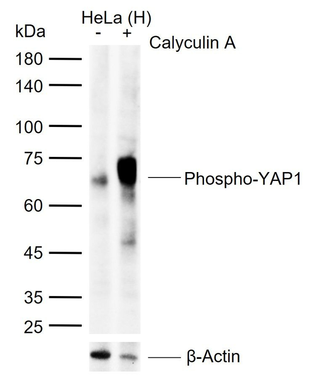 Phospho-YAP1 (Ser127) Antibody in Western Blot (WB)