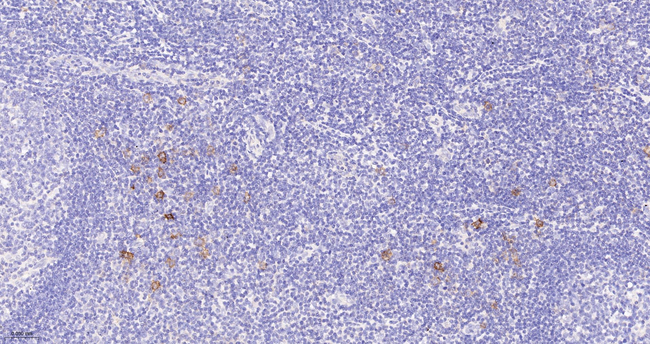 CD30 Antibody in Immunohistochemistry (Paraffin) (IHC (P))