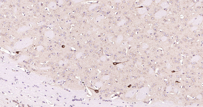 ChAT Antibody in Immunohistochemistry (Paraffin) (IHC (P))