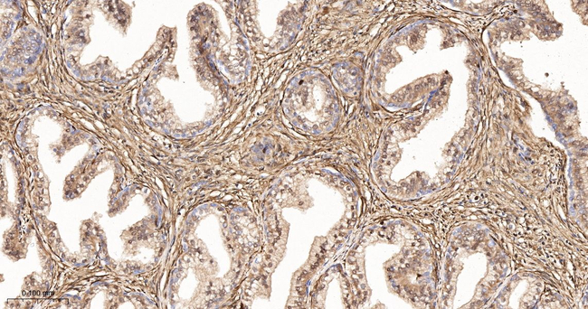 S100A4 Antibody in Immunohistochemistry (Paraffin) (IHC (P))