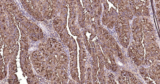 MUC1 Antibody in Immunohistochemistry (Paraffin) (IHC (P))