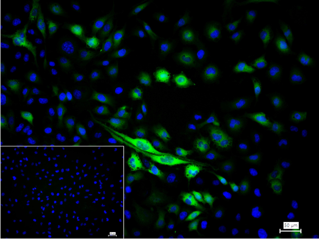 TGM2 Antibody in Immunocytochemistry (ICC/IF)