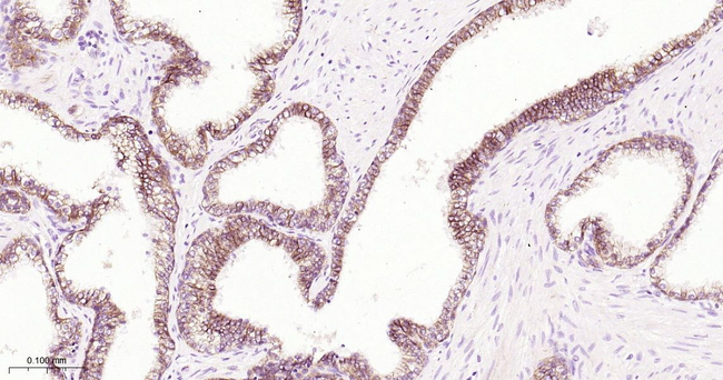 beta Catenin Antibody in Immunohistochemistry (Paraffin) (IHC (P))