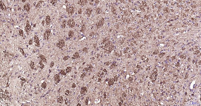 NF-L Antibody in Immunohistochemistry (Paraffin) (IHC (P))