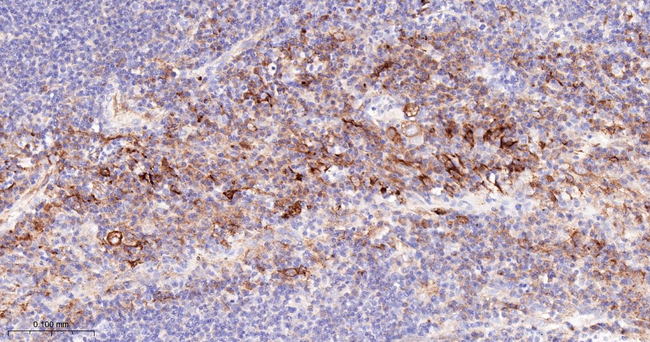 TGM2 Antibody in Immunohistochemistry (Paraffin) (IHC (P))