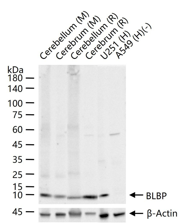 FABP7 Antibody in Western Blot (WB)