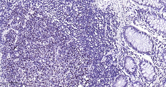 PMS2 Antibody in Immunohistochemistry (Paraffin) (IHC (P))