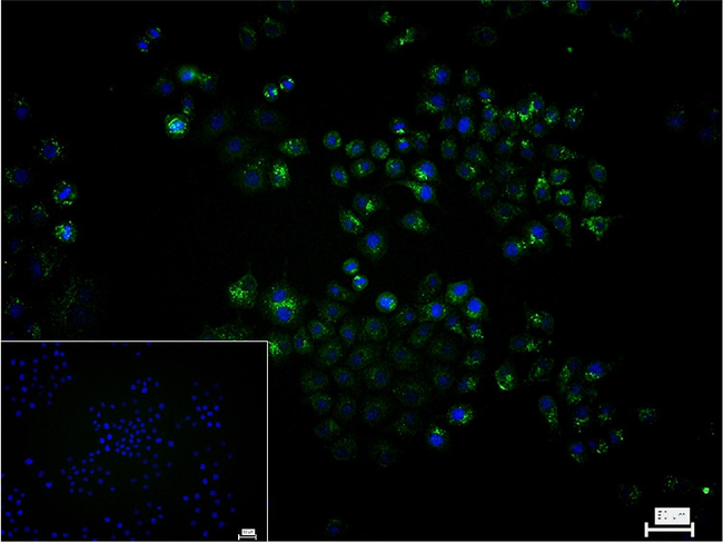 CLN2 Antibody in Immunocytochemistry (ICC/IF)