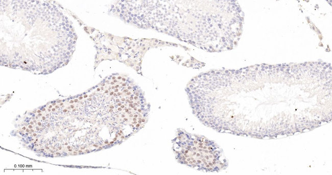 p21 Antibody in Immunohistochemistry (Paraffin) (IHC (P))