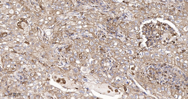 uPAR Antibody in Immunohistochemistry (Paraffin) (IHC (P))