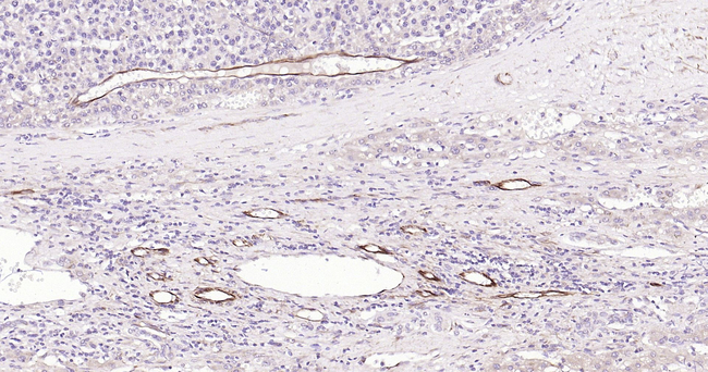 VEGF Antibody in Immunohistochemistry (Paraffin) (IHC (P))