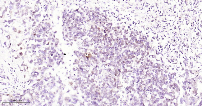 Myogenin Antibody in Immunohistochemistry (Paraffin) (IHC (P))