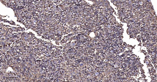 Arginase 1 Antibody in Immunohistochemistry (Paraffin) (IHC (P))