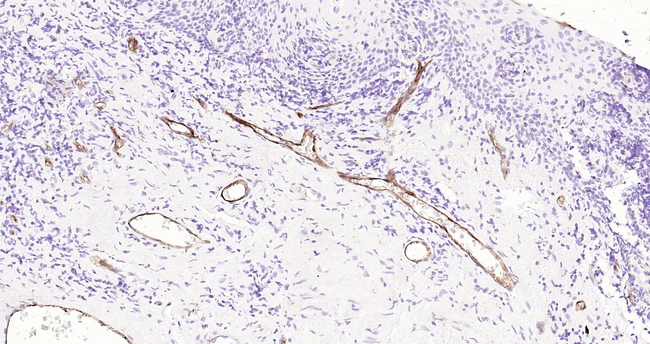 P-Selectin Antibody in Immunohistochemistry (Paraffin) (IHC (P))