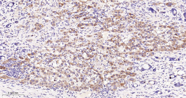 EIF2S1 Antibody in Immunohistochemistry (Paraffin) (IHC (P))
