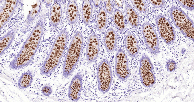 MUC2 Antibody in Immunohistochemistry (Paraffin) (IHC (P))