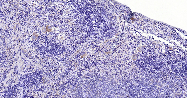 CD42b Antibody in Immunohistochemistry (Paraffin) (IHC (P))
