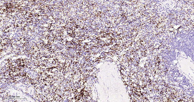 CD42b Antibody in Immunohistochemistry (Paraffin) (IHC (P))
