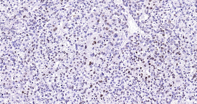 Arginase 1 Antibody in Immunohistochemistry (Paraffin) (IHC (P))
