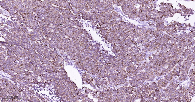 Cytokeratin 7 Antibody in Immunohistochemistry (Paraffin) (IHC (P))