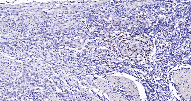 MSH6 Antibody in Immunohistochemistry (Paraffin) (IHC (P))