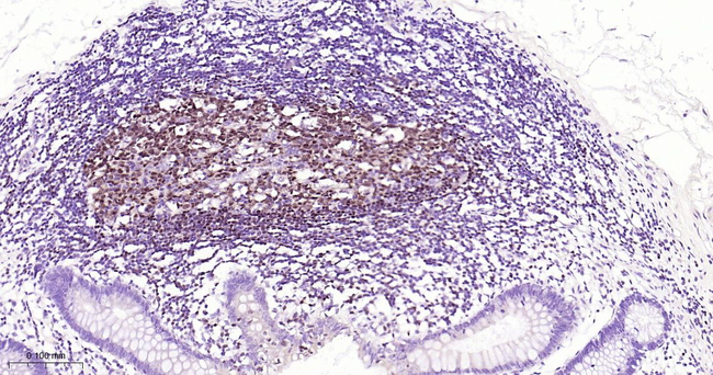 PAX5 Antibody in Immunohistochemistry (Paraffin) (IHC (P))