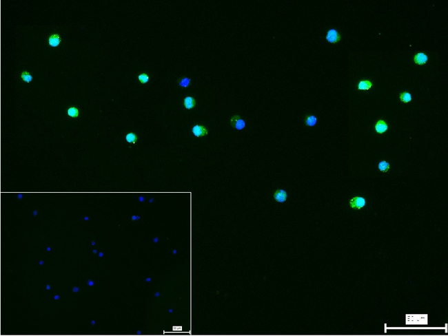 BCL6 Antibody in Immunocytochemistry (ICC/IF)
