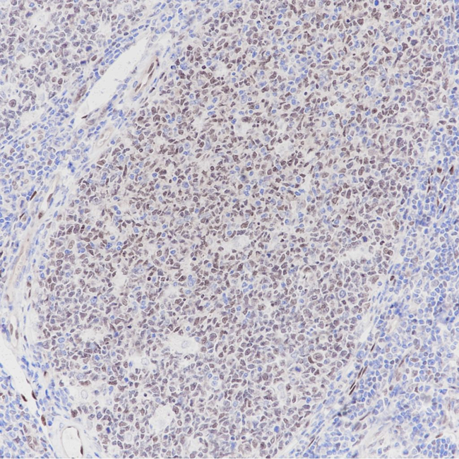 LMO2 Antibody in Immunohistochemistry (Paraffin) (IHC (P))