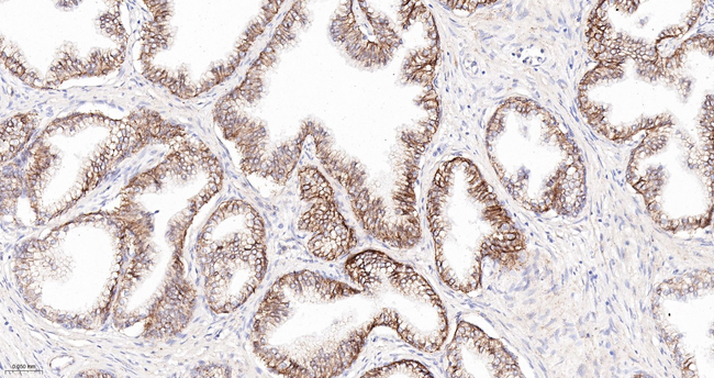 delta Catenin Antibody in Immunohistochemistry (Paraffin) (IHC (P))