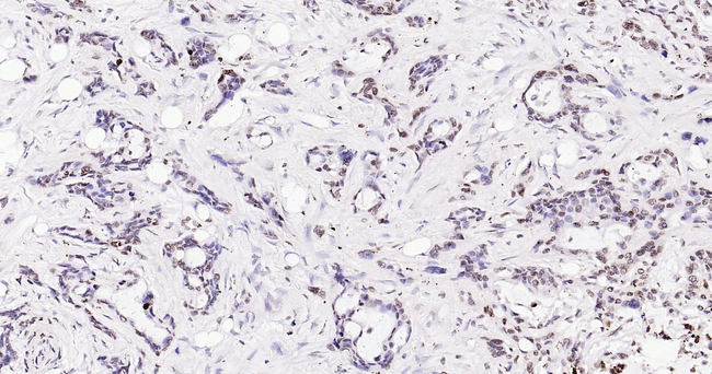 ERCC1 Antibody in Immunohistochemistry (Paraffin) (IHC (P))