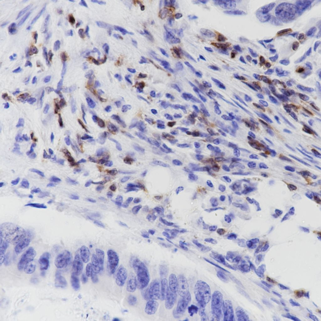CD7 Antibody in Immunohistochemistry (Paraffin) (IHC (P))
